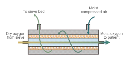 หลักการทำงานของเครื่องผลิตออกซิเจน และการเลือกซื้อ Siam Oxygen